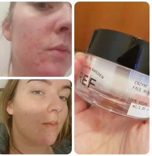 img_1164 قناع تقشير إنزيمي للوجه من ماركة REF Stockholm Sweden.