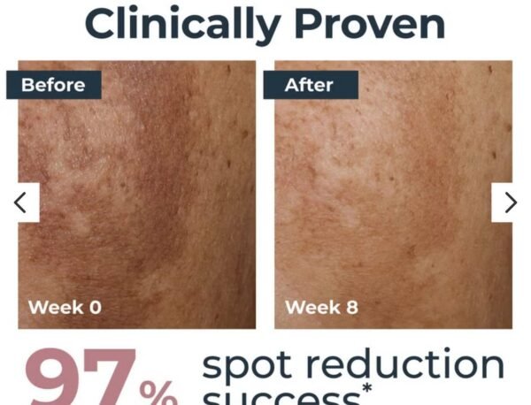 Eucerin Anti-Pigment Day Cream SPF 30
كريم نهاري علاجي للتصبغات، يوحد لون البشرة ويحميها من الشمس بنفس الوقت