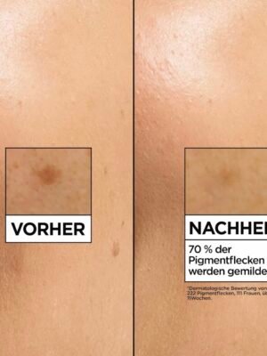 ✨

سيروم Garnier SkinActive Vitamin C Glow Booster✨ (30ml)
إذا بشرتچ باهتة أو بيها بقع وآثار حبوب