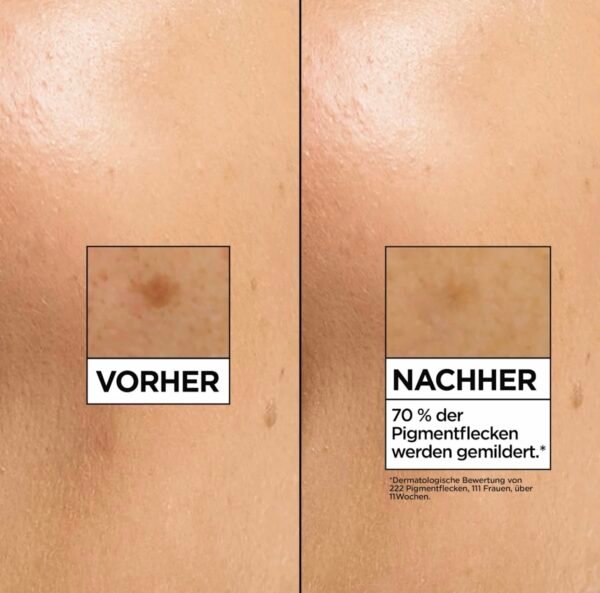 screenshot-277 يروم Garnier Vitamin C+ Glow Booster
إذا بشرتچ باهتة أو بيها آثار حبوب وتصَبّغات