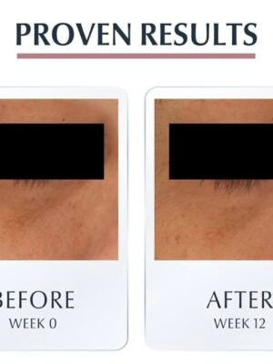 Eucerin Anti-Pigment Dark Circle Eye Cream
كريم عيون مخصص للهالات السوداء والتصبغات، ينوّر منطقة العين ويخليها فريشة ومرتاحه