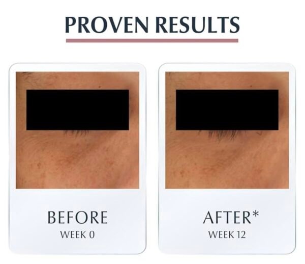 screenshot-336 Eucerin Anti-Pigment Dark Circle Eye Cream
كريم عيون مخصص للهالات السوداء والتصبغات، ينوّر منطقة العين ويخليها فريشة ومرتاحه